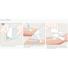 Load image into Gallery viewer, Molnlycke Sodium Chloride Impregnated Dressing Mesalt® Ribbon 3/4 X 39 Inch Sterile #285280
